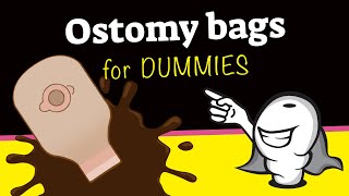 Ostomy bags for dummies [upl. by Elletsyrc197]