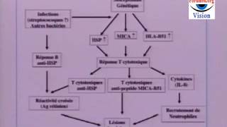 Les Symptômes de la Maladie de Behçet [upl. by Marie-Ann150]