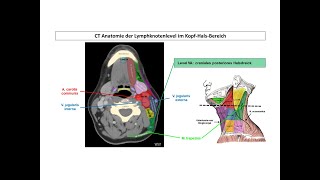 CT Anatomie der Lymphknotenlevel im KopfHalsBereich  Strahlentherapie Prof Hilke Vorwerk [upl. by Rai237]