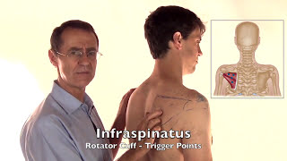 Trigger Point Release  Infraspinatus Muscle [upl. by Anrol578]