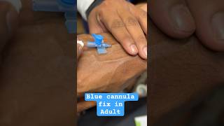 Intravenous cannulation for Adult  trending hospital doctor cannula SMpharmacy plz follow [upl. by Hege758]