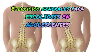 Ejercicios generales para ESCOLIOSIS EN ADOLESCENTES [upl. by Ayitahs993]