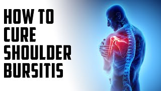 How to cure shoulder bursitis  A Episode 30 [upl. by Beichner]