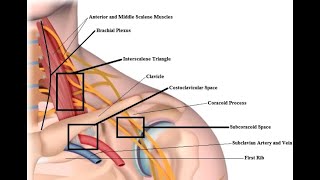 Thoracic Outlet Syndrome TOS vs Cervical Radiculopathy [upl. by Attenyt347]