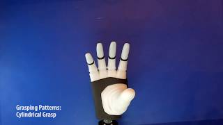 DeTOP project  Sensorized Hand Prosthesis [upl. by Ellenor]