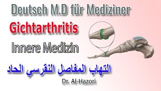 Gichtanfall Arthritis urica  Innere Medizin  التهاب المفاصل النقرسي [upl. by Aruasor271]