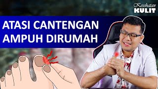 TIPS AMPUH MENGOBATI CANTENGAN  DOKTER SADDAM ISMAIL [upl. by Ruhnke]