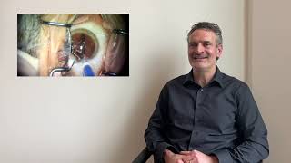 Mark S  RLE refractive lens exchange with multifocal lenses and femtosecond laser Testimonial [upl. by Nerra]