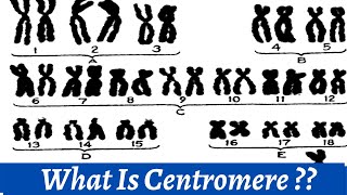 Centromere And Kinetochore  How we use centromere to classify chromosomes   Histology [upl. by Rustice]