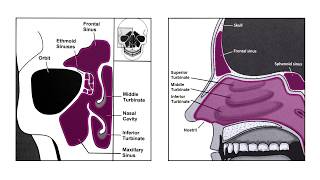 Nasal Endoscopy and Sinus Anatomy [upl. by Nylsirhc]