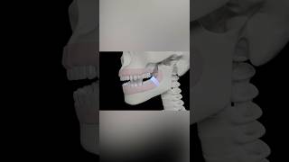 Wisdom Tooth Inflammation dentistteeth dentist oralhealth [upl. by Cherilyn]