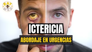 ICTERICIA  ABORDAJE CLÍNICO DE URGENCIAS🚨 [upl. by Okajima582]