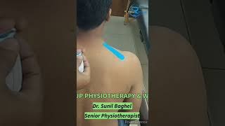 taping for trapezitisHow do you relieve trapezius pain in the neck trapezitis neckpain [upl. by Cartan]