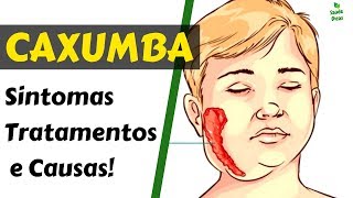 Caxumba Sintomas Tratamentos e Causas [upl. by Laersi169]