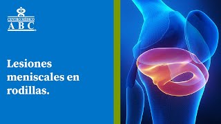 Webinar Lesiones meniscales en rodillas [upl. by Schonfield]