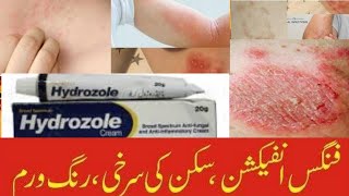 Hydrozole cream  Hydrozole Clotrimazole Hydrocortisone Uses and side effects in urdu and Hindi [upl. by Biel]