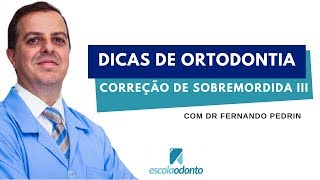 Dicas de ortodontia Como intruir os dentes inferiores [upl. by Dunton]