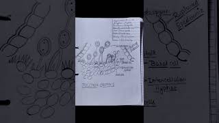 puccinia graminis  bsc 1st semester  botany bsc 1st semester shorts bscbotany [upl. by Lauro]