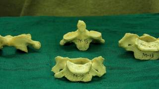 Vertebrae  How to differentiate them [upl. by Foley688]