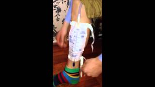 Using a Legbag for the GeeWhiz Condom Catheter for Male Urinary Incontinence [upl. by Ralat]