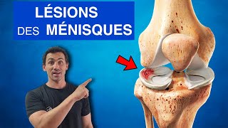 Voici des causes de l’arthrose du genou arthrose genou pathologie douleurs [upl. by Aizirk]