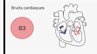 Lauscultation cardiaque  Baladodiffusion [upl. by Ydoow]