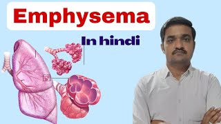 Emphysema in hindi  cause type pathology symptoms  nursing class  Bsc nursing  COPD [upl. by Art]