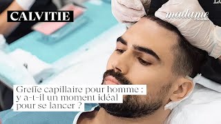 👨‍🦲 Greffe capillaire pour homme  y atil un moment idéal pour se lancer  calvitie [upl. by Novyak910]