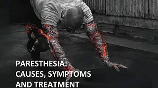 Paresthesia Causes Symptoms and Treatment [upl. by Eanod]