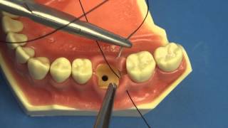 Surgical Technique  Figure of Eight Close Vertical Dental amp Medical Suturing by Stuart OrtonJones [upl. by Asilim]