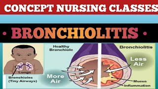 Bronchiolitis causesign symptoms treatment and prevention [upl. by Derron]