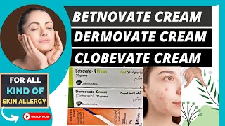 Betnovate Clobevate and Dermovate Creams Which One is Right for Hands foot and skin allergy [upl. by Gelman449]