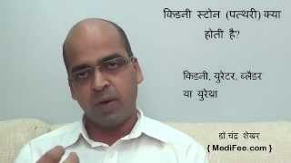 Kidney Stones Signs and Symptoms  Diagnosis  Prevention  Causes in Hindi [upl. by Everett203]