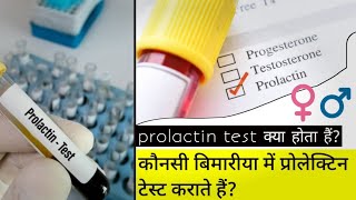 prolactin test in hindi prolactin test kyu karte hai [upl. by Gnok]