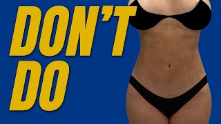 15 Things NOT to do After Having Liposuction [upl. by Anoiek]