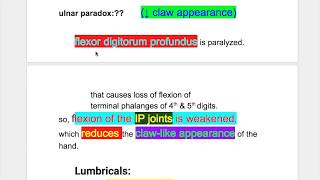 Ulnar nerve palsy Incomplete Claw hand [upl. by Konikow712]