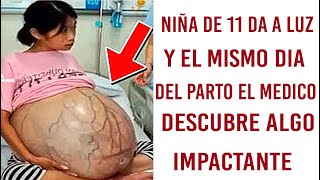 Niña De 11 Años Da A Luz Y El Mismo Día Del Parto El Doctor Descubre Algo Impactante [upl. by Aryajay]