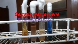 Serratia marcescens Biochemical tests Demonstration [upl. by Allisan435]