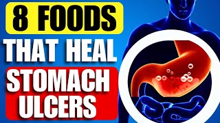 Top 8 Foods to Heal Your Stomach Ulcer Naturally [upl. by Doe]