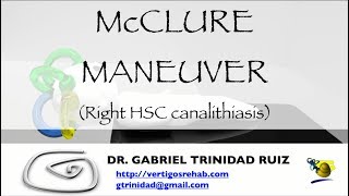 McCLURE MANEUVER RIGHT HSC CANALITHIASIS [upl. by Oibesue]