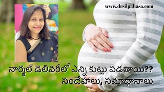 Stitches in normal delivery  నార్మల్ డెలివరీ లో వేసే కుట్లు సందేహాలు [upl. by Deeyn]