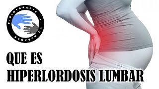 Hiperlordosis lumbar que es y porque se produce [upl. by Ayifas456]