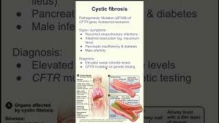 Cystic fibrosis [upl. by Tillie725]