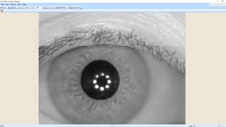 IRIS recognition Using CNN on Casia dataset  919872993883 for query  Total class 224 [upl. by Ilil]