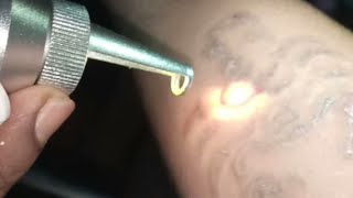 laser tattoo removal shop  connaught place Delhi  3N vlogs [upl. by Onin]