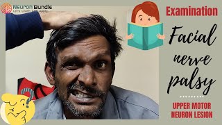 facial nerve palsy  7th cranial nerve  upper motor neuron lesion cnsexamination neurology [upl. by Neelahtak]