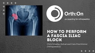 How to Perform a Fascia Iliac Compartment Block [upl. by Chancelor]