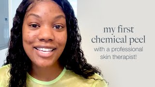 My first chemical peel with a professional skin therapist [upl. by Maccarthy391]