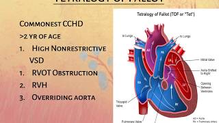 Cyanotic Congenital Heart Disease PPT  MBBS PPT [upl. by Kcyred]