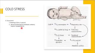 NCLEX REVIEW ON NEONATAL COMPLICATIONS [upl. by Aelhsa256]